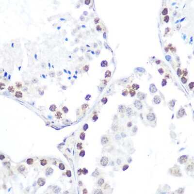 Immunohistochemistry-Paraffin: AMPK beta 1 [p Ser182] Antibody - Azide and BSA Free [NBP3-16943]
